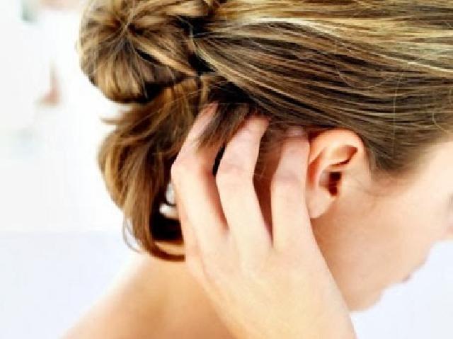 5 Tips Menghilangkan Kutu Rambut