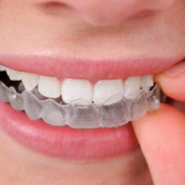 Gigi Palsu Ternyata Sudah Dipakai Sejak Empat Abad Lalu