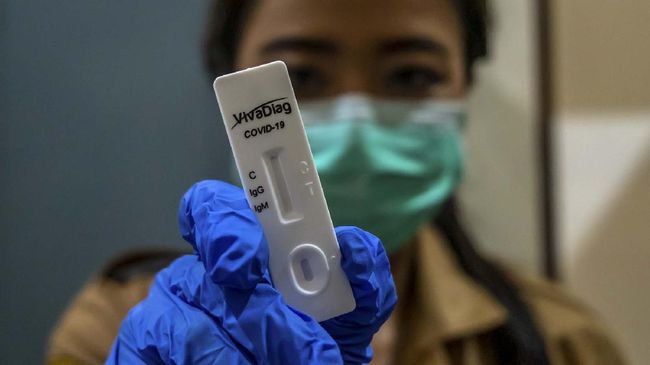 Keren, Indonesia Akan Produksi 2 Juta Alat Rapid Test Corona