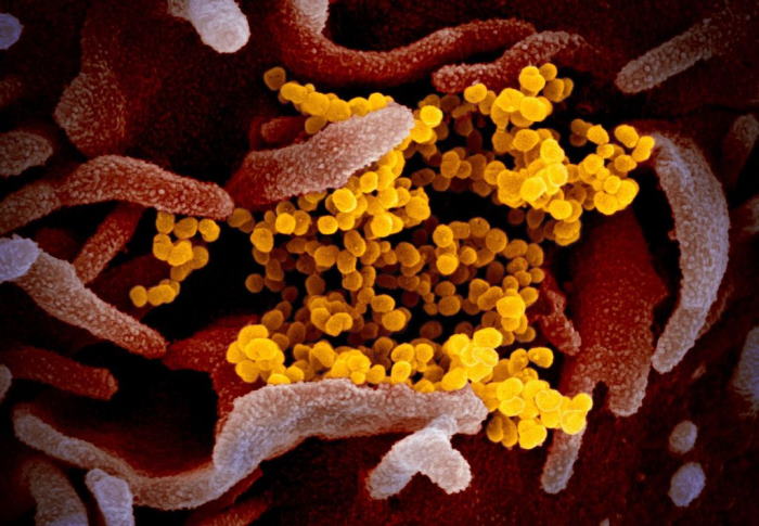 5 Gejala Terjangkit Virus Corona yang Tidak Umum Diketahui