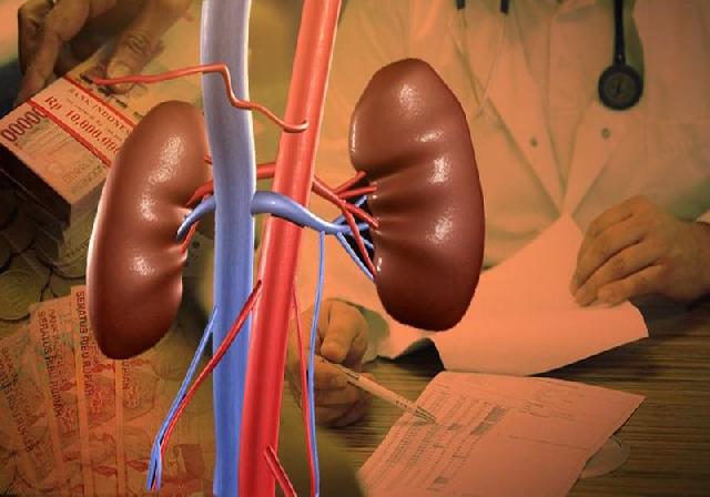 Cerita tentang  Jual Ginjal di Majalaya