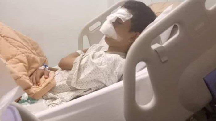 Polisi Periksa Lima Saksi Terkait Perundungan Pelajar di Pekanbaru