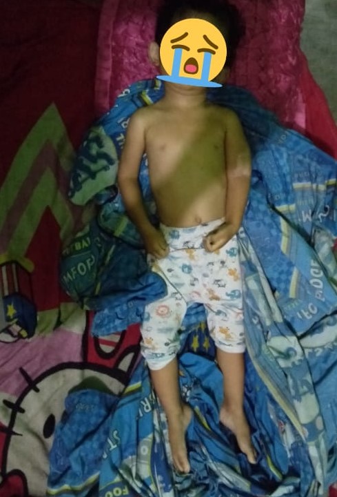 Bocah Perempuan 1,5 Tahun Tewas Dianiaya Ayah Tiri di Pekanbaru