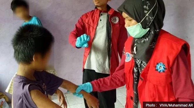 Satu Keluarga Terjangkit Penyakit Kulit, Warga Khawatir Cacar Monyet