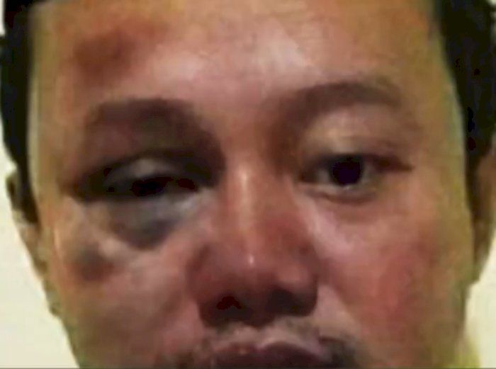 Foto Herry Wirawan Babak Belur, Kepala Rutan: Tidak Benar!