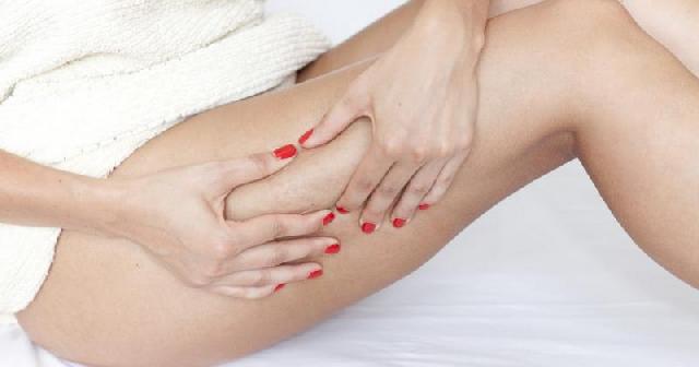 3 Tips Mengatasi Selulit