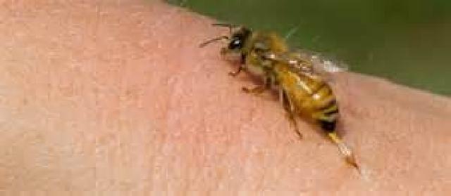 Penting, Pertolongan Pertama Untuk yang Tersengat Lebah