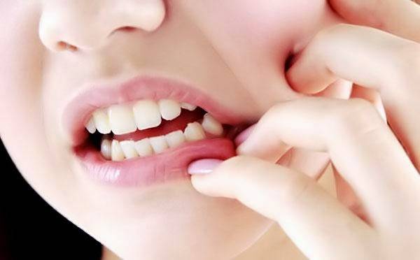 Lakukan 4 Cara Ini Atasi Gigi Sensitif
