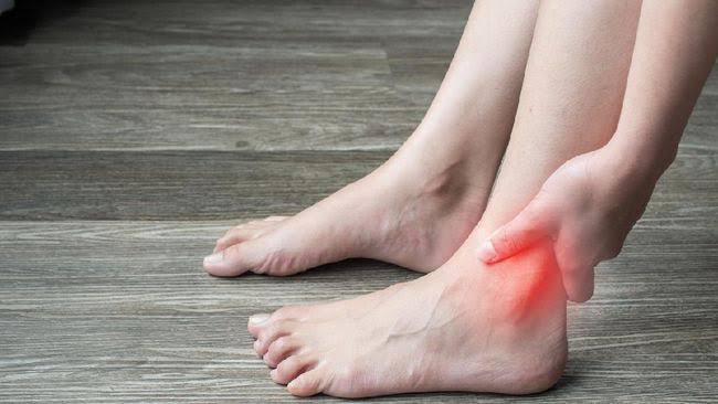 Punya Asam Urat? Cobain 8 Pengobatan Alami Rumahan Ini