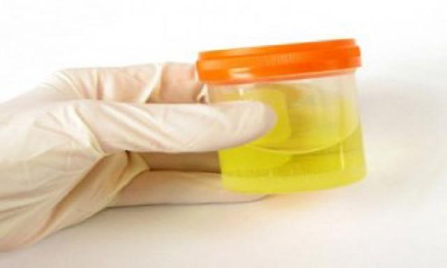 BNK Tes Urine di Disdukcapil