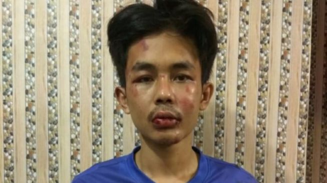 Sebelum Tusuk Syekh Ali Jaber, Ibu Sebut Alpin Kesurupan Dengar Azan dan Ayat Alquran