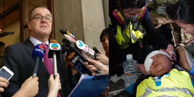 Mata Kanan Jurnalis WNI Buta Permanen Usai Ditembak Polisi Hong Kong