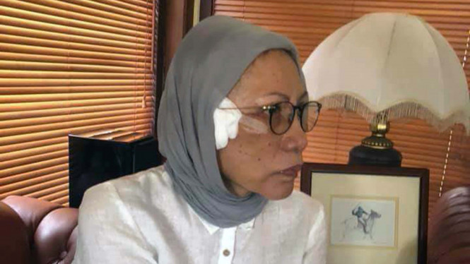 Polisi: 21 September, Ratna Sarumpaet ke RS Khusus Bedah