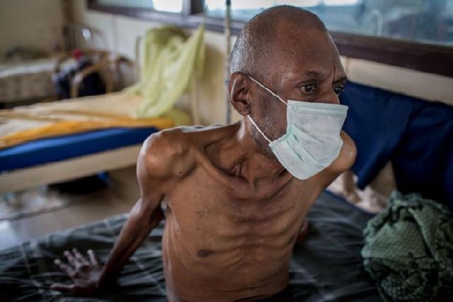 Peringati Hari TBC se-Dunia, Biddokkes Polda Riau Adakan Penyuluhan di Kampar