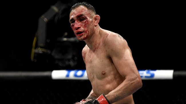 Wajah Hancur Dihajar Gaethje, Ferguson Berlumuran Darah Dibawa ke Rumah Sakit