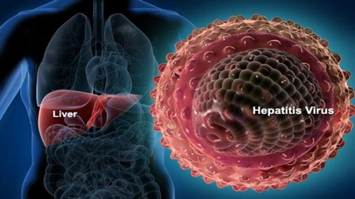 Hati-hati, Hepatitis Akut Bisa Saja Menyerang Orang Dewasa