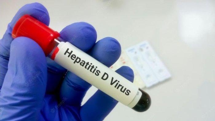 Waspada Hepatitis Akut Menyerang Anak-anak, Segera Tes Fungsi Hati
