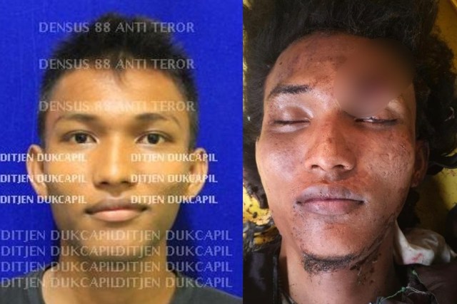 Polisi Sebut Pelaku Bom Bunuh Diri di Medan Diduga Terpapar dari Istri