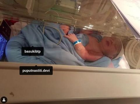 Anak Pertama Ahok dari Puput Diberi Nama Yosafat Abimanyu Purnama