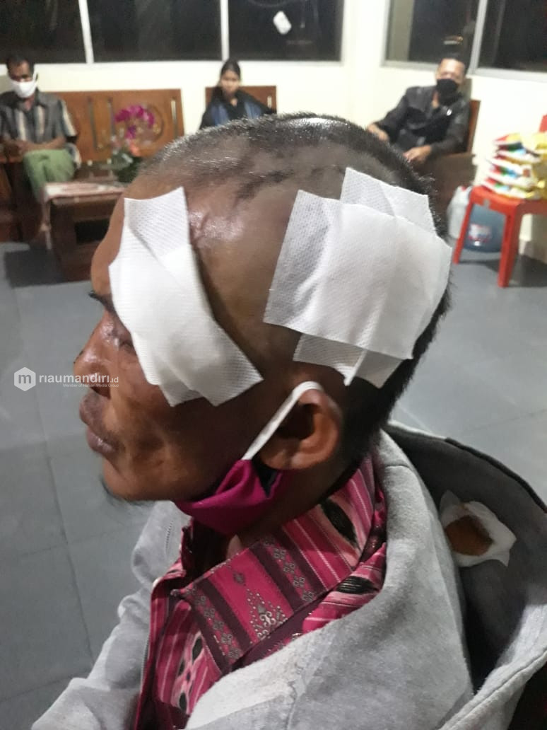 Pria di Rumbai Pekanbaru Pukul Kepala Ayah Tiri Pakai Botol Kaca Sampai Tumbang