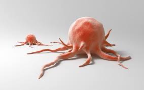 Kanker Payudara Bisa Menyebar ke Organ Lain, Wajib Deteksi Sejak Dini