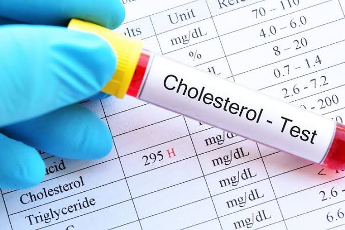 Tak Perlu Minum Obat, Ini Cara Alami Turunkan Kolesterol