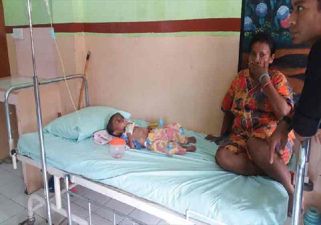 Roni, Bayi Dua Tahun Menderita Gizi Buruk