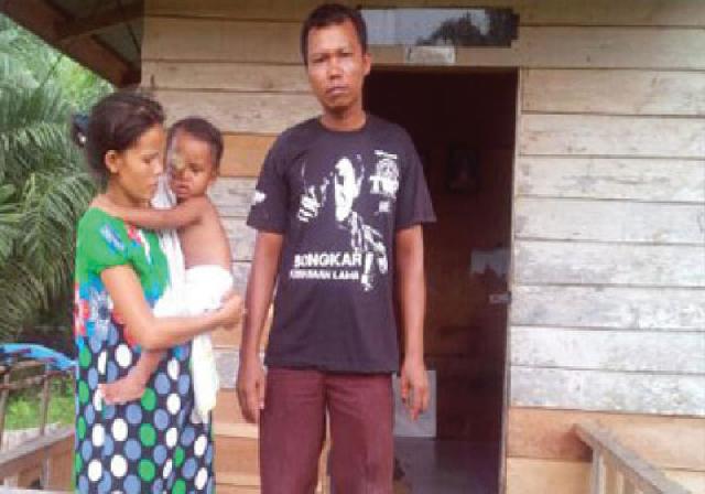 Diskes Riau Tanggung Biaya Perawatan Tumor Mata M Fathir