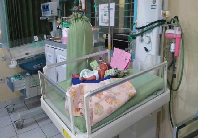 Bayi Prematur Dirawat tanpa Inkubator