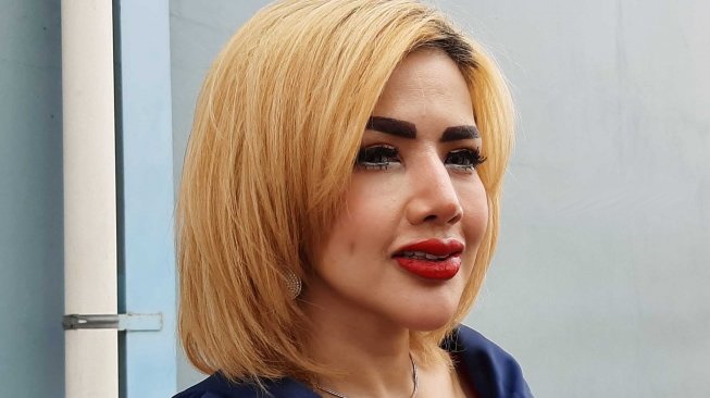 Bibir Dower Usai Disulam Dicibir Warganet, Barbie Kumalasari Ngaku Mirip Joker