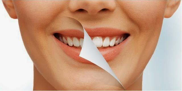 3 Tips Mudah dan Alami Membuat Gigi Tampak Putih