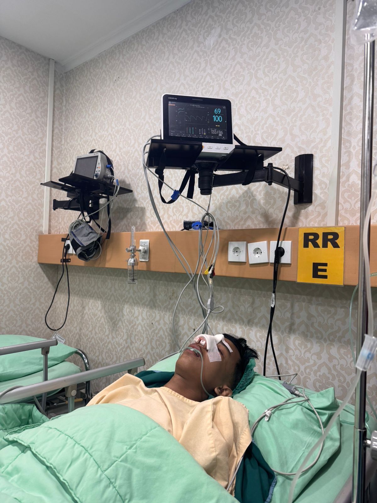 Siswa SMA di Pekanbaru Diduga Alami Perundungan: Patah Tulang Hidung