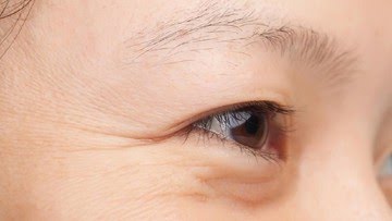 Menghindari Penuaan Dini, Berikut Cara Merawat Kulit Sekitar Mata