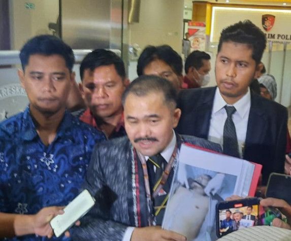 Dugaan Pembunuhan Berencana, Kuasa Hukum Keluarga Brigadir J Melapor ke Polisi