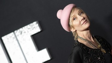 Aktris Cantik Ini Alami Mati Otak Akibat Kecelakaan