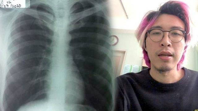 Dokter Tirta Ngaku Tobat Usai Lihat Foto Rontgen Paru-parunya, Ternyata Bukan karena Corona