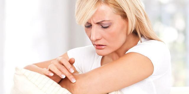 Intip 3 Cara Alami Hilangkan Bekas Luka Bakar