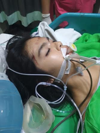 Wanita Korban Jambret di Jalan Sudirman Pekanbaru Saat Ini Koma