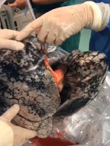 Viral Paru-paru Hitam, Begini Penjelasan Dokter