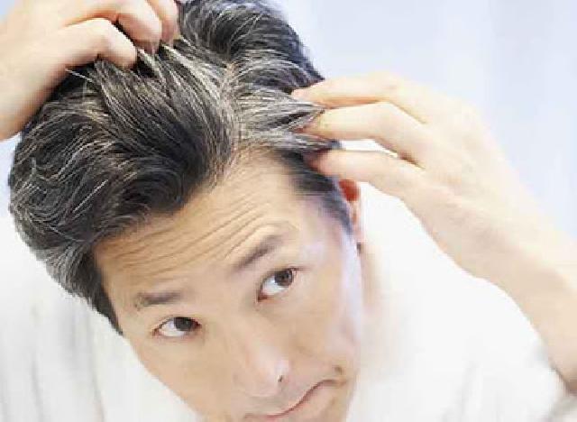 Penyebab Timbulnya Uban di Usia Muda