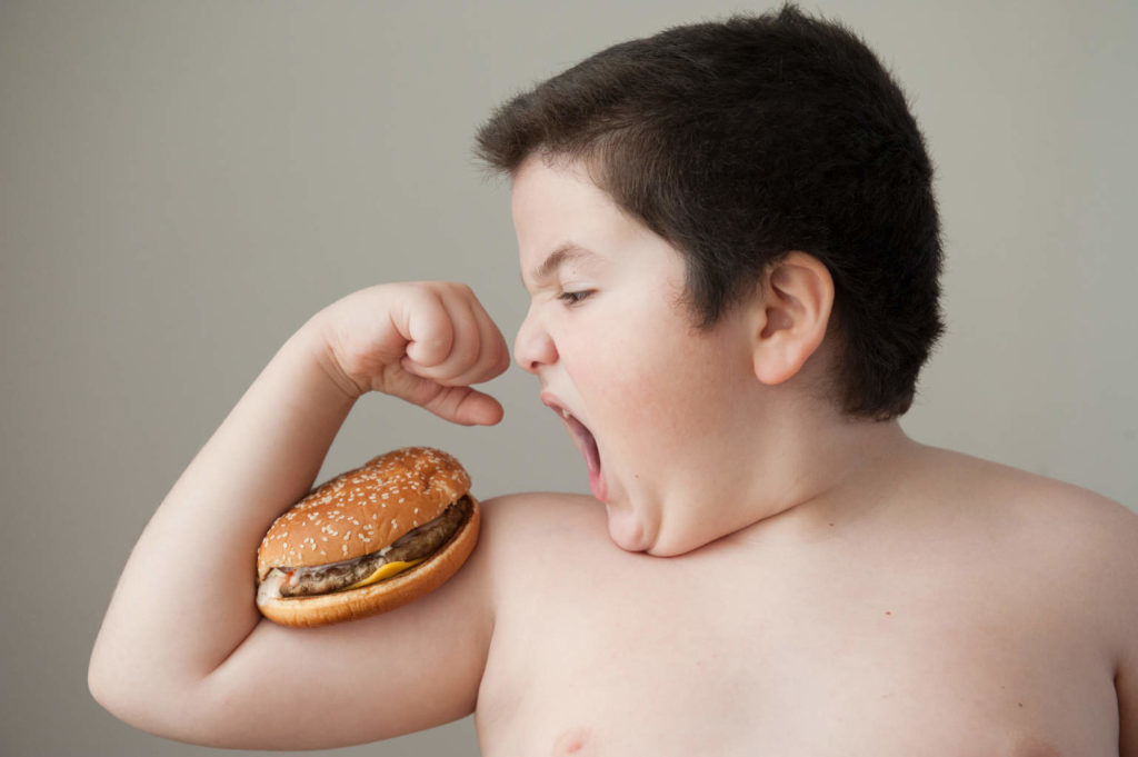 Kenali Bahaya Obesitas pada Anak