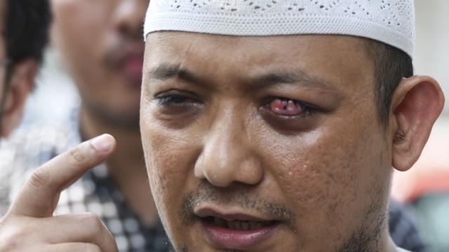 Polisi Tangkap Pelaku Penyiram Air Keras ke Novel Baswedan