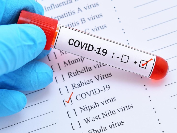 Covid-19 Meningkat di Negara Asia, Dinkes Riau Imbau Masyarakat Berperilaku Hidup Bersih