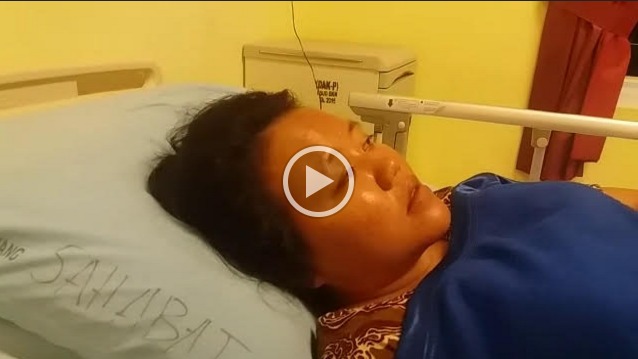 Begini Pengakuan Korban Ricuh RTK VS Satpol PP Kampar